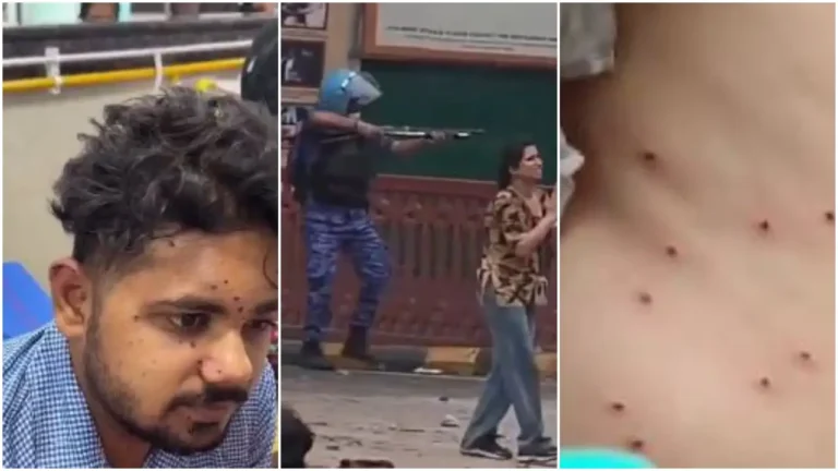കേന്ദ്രം നുണ പറയുന്നത് അവസാനിപ്പിക്കണം, രാജ്യത്തെ യുവതലമുറയുടെ അവകാശങ്ങൾക്കു നേരെയുള്ള ആക്രമണമാണിത് ; പെല്ലറ്റ് ആക്രമണത്തിന് ഇരയായ വിദ്യാര്ഥിയെ ഒപ്പം നിര്ത്തി രാഹുല് ഗാന്ധി കേന്ദ്രം നുണ പറയുന്നത് അവസാനിപ്പിക്കണം, രാജ്യത്തെ യുവതലമുറയുടെ അവകാശങ്ങൾക്കു നേരെയുള്ള ആക്രമണമാണിത് ; പെല്ലറ്റ് ആക്രമണത്തിന് ഇരയായ വിദ്യാര്ഥിയെ ഒപ്പം നിര്ത്തി രാഹുല് ഗാന്ധി